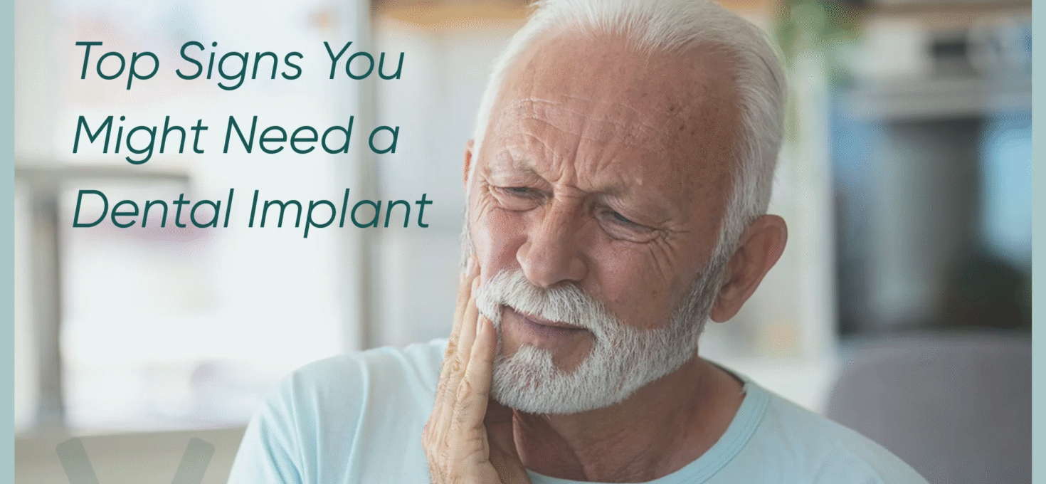 8 Signs That You Need Dental Implants: A Complete Guide