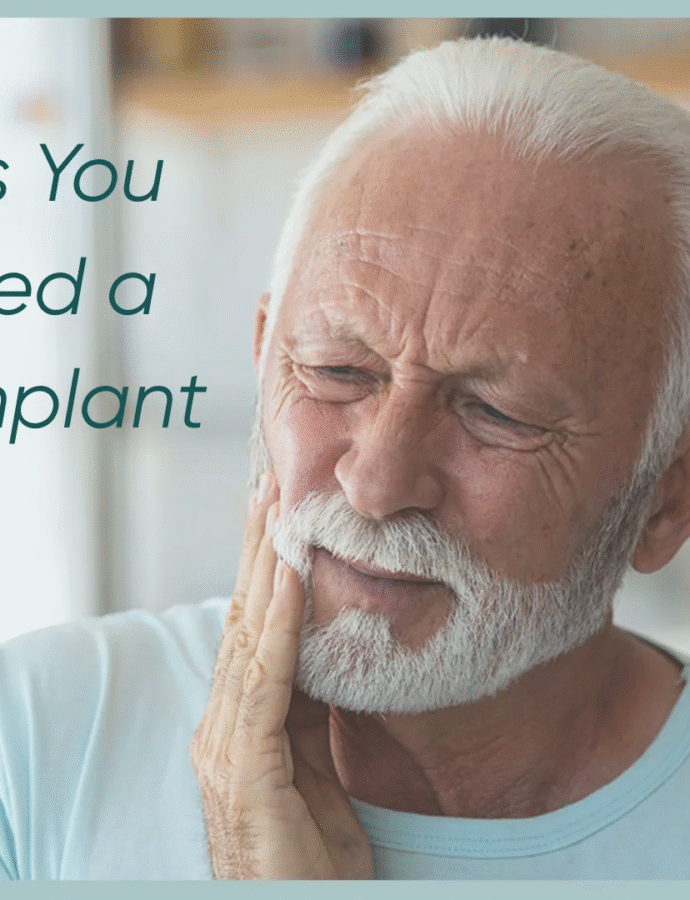 8 Signs That You Need Dental Implants: A Complete Guide